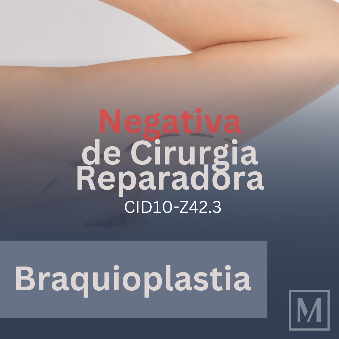 Negaram sua Braquioplastia (CID10-Z42.3) Reparadora? Entenda como garantir esse direito essencial à sua saúde